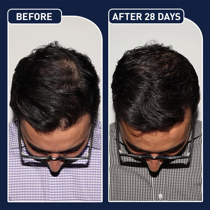 FEG Plus Hair Growth Spray – Stimulate Follicles, Reduce Hair Fall, and Encourage Thicker, Healthier Growth 60ML