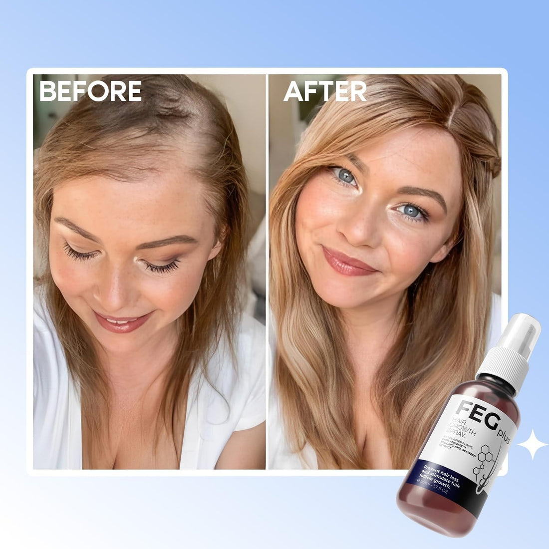 FEG Plus Hair Growth Spray – Stimulate Follicles, Reduce Hair Fall, and Encourage Thicker, Healthier Growth 60ML
